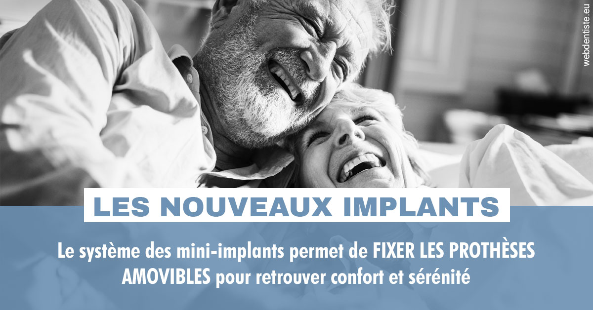 https://www.orthodontie-rosilio.fr/Les nouveaux implants 2