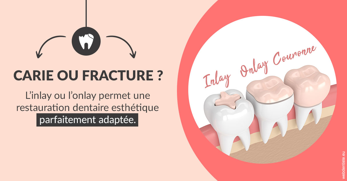 https://www.orthodontie-rosilio.fr/T2 2023 - Carie ou fracture 2