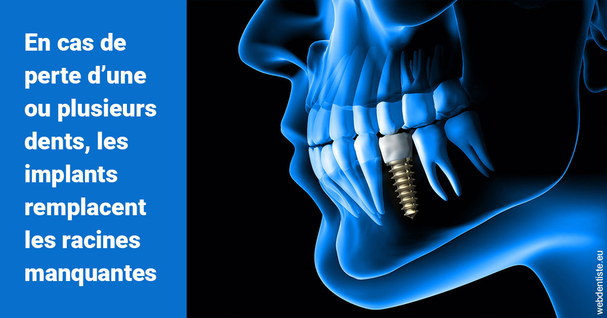 https://www.orthodontie-rosilio.fr/Les implants 1