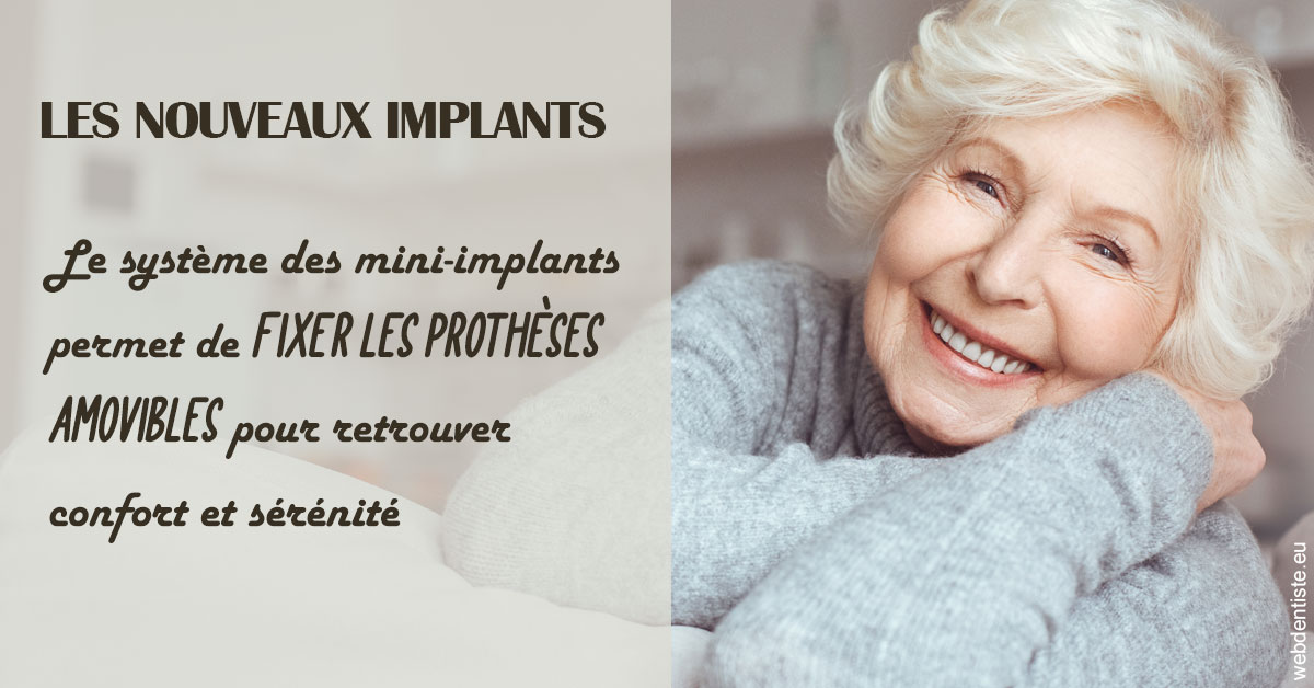 https://www.orthodontie-rosilio.fr/Les nouveaux implants 1