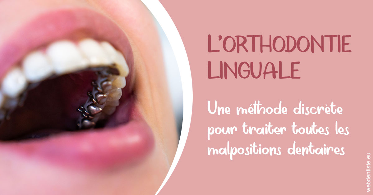 https://www.orthodontie-rosilio.fr/L'orthodontie linguale 2