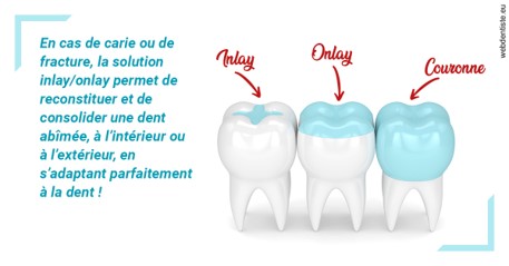 https://www.orthodontie-rosilio.fr/L'INLAY ou l'ONLAY