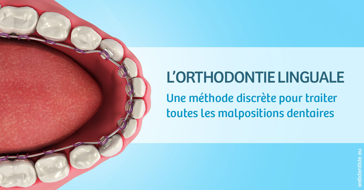 https://www.orthodontie-rosilio.fr/L'orthodontie linguale 1