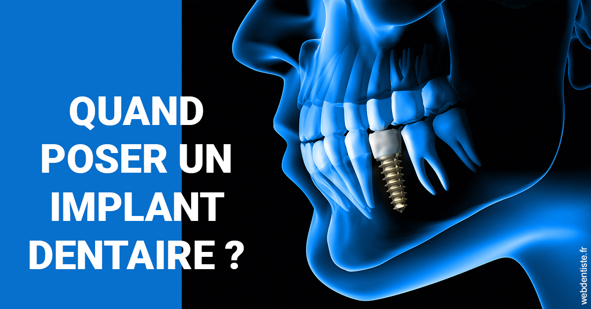 https://www.orthodontie-rosilio.fr/Les implants 1