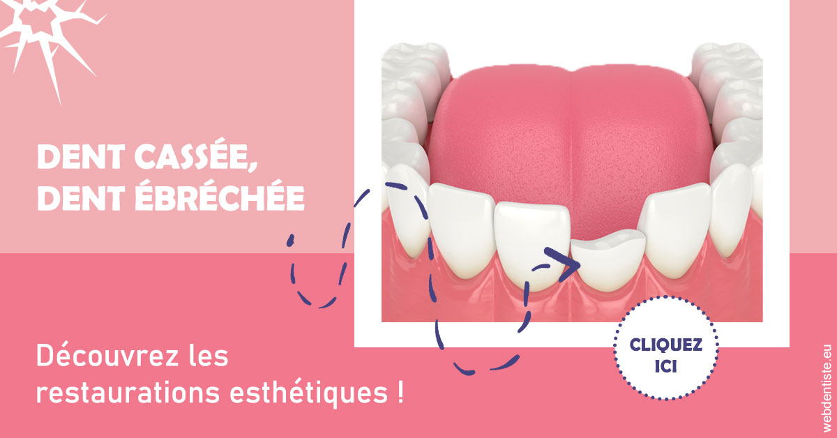 https://www.orthodontie-rosilio.fr/Dent cassée ébréchée 1