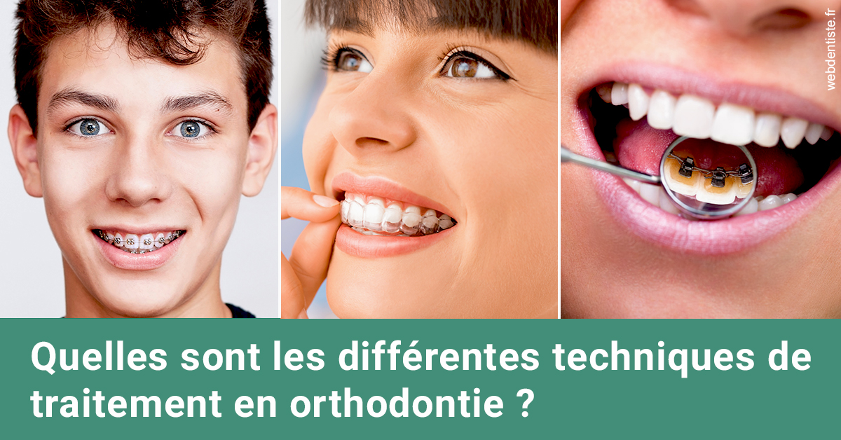 https://www.orthodontie-rosilio.fr/Les différentes techniques de traitement 2