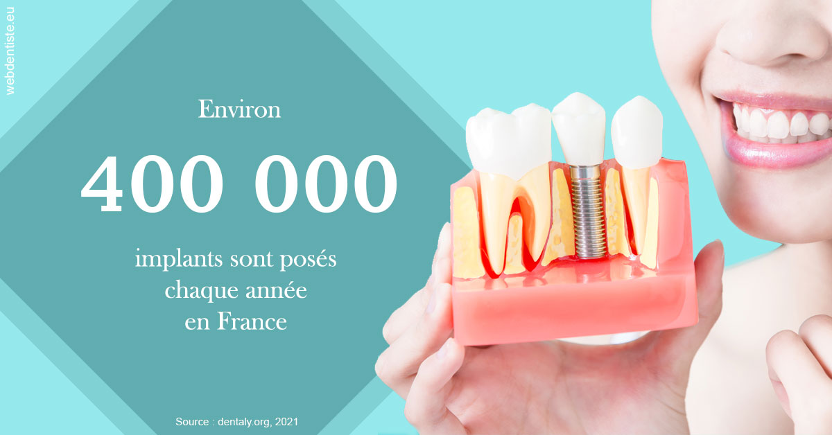 https://www.orthodontie-rosilio.fr/Pose d'implants en France 2