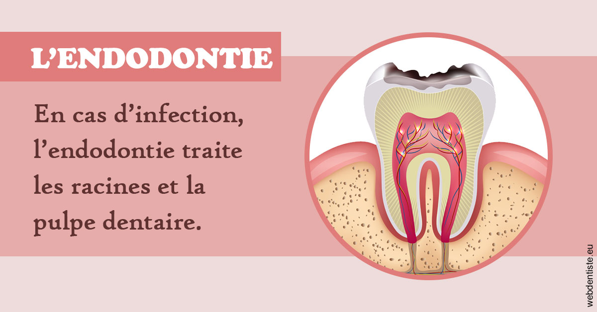 https://www.orthodontie-rosilio.fr/L'endodontie 2