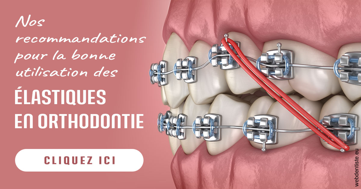 https://www.orthodontie-rosilio.fr/Elastiques orthodontie 2